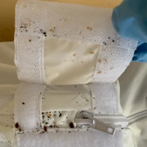Bed Bug Exterminator finds an infestation